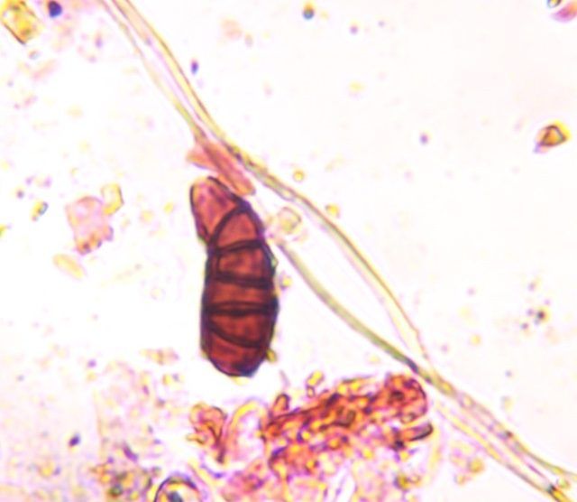 Curvularia mold spore under a microscope, verified by PollyMap