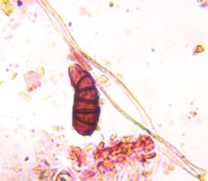 Curvularia mold spore under a microscope, verified by PollyMap