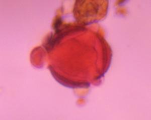 Artemisia pollen under a microscope, verified by PollyMap