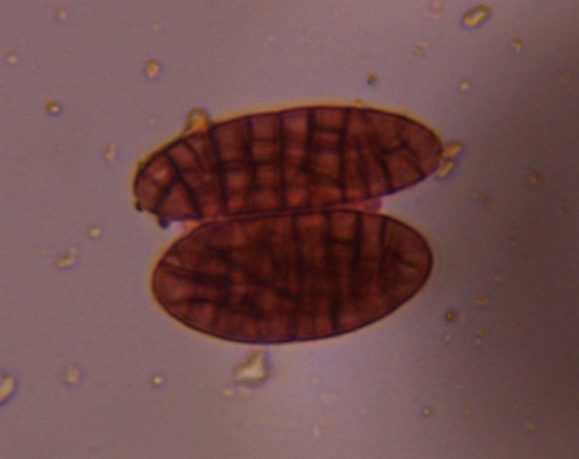 Microscope image of Pithomyces, verified by PollyMap