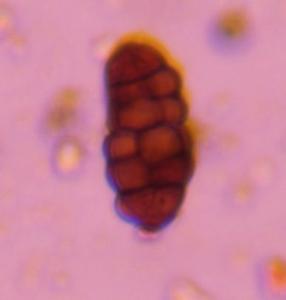 Pleospora mold spore under a microscope, verified by PollyMap