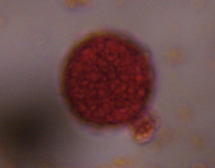 Chenopod pollen under a microscope, verified by PollyMap