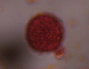 Chenopod pollen under a microscope, verified by PollyMap