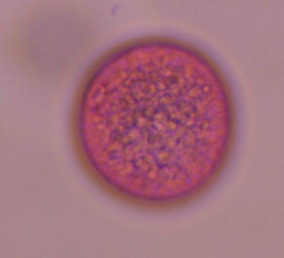 Another microscope image of Poaceae, verified by PollyMap