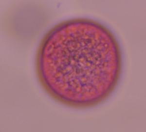 Poaceae pollen under a microscope, verified by PollyMap