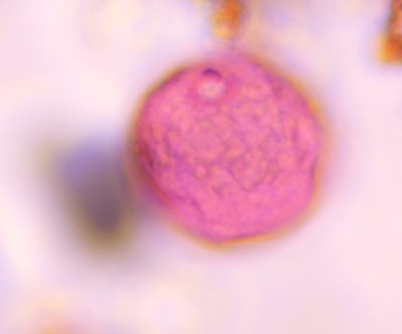 Poaceae pollen under a microscope, verified by PollyMap