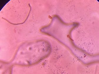 Microscope image of Synthetic or Cellulose Fiber, verified by PollyMap