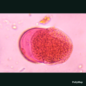 Poaceae pollen under a microscope, verified by PollyMap