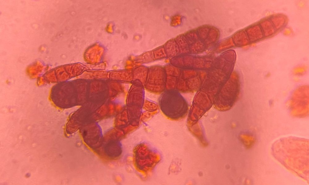 Another microscope image of Alternaria, verified by PollyMap