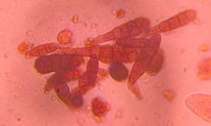 Alternaria mold spore under a microscope, verified by PollyMap