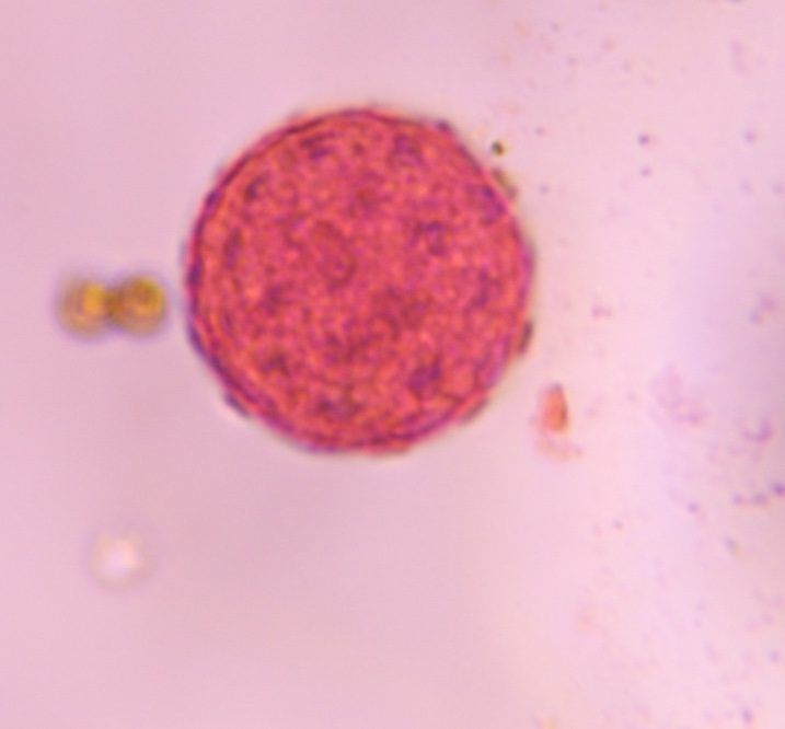 Chenopod pollen under a microscope, verified by PollyMap