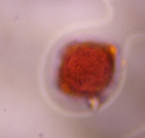 Chenopod pollen under a microscope, verified by PollyMap