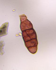Alternaria mold spore under a microscope, verified by PollyMap