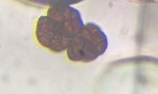 Stemphylium mold spore under a microscope, verified by PollyMap