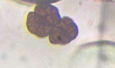Stemphylium mold spore under a microscope, verified by PollyMap