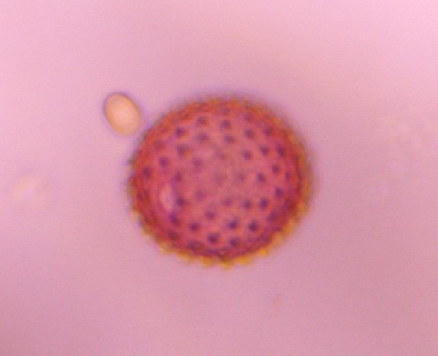 Asteraceae pollen under a microscope, verified by PollyMap