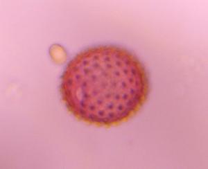 Asteraceae pollen under a microscope, verified by PollyMap
