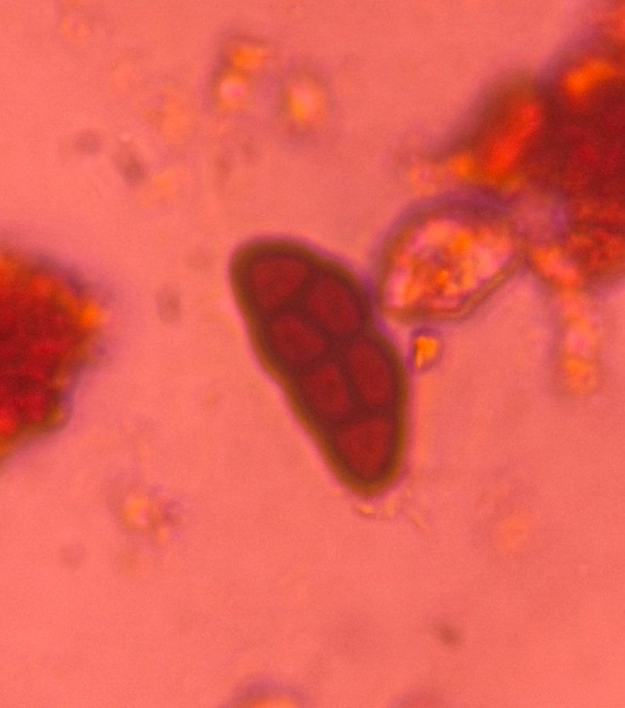 Pithomyces mold spore under a microscope, verified by PollyMap