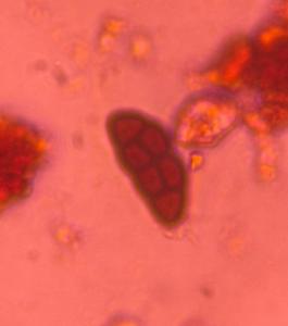 Pithomyces mold spore under a microscope, verified by PollyMap