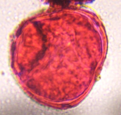Another microscope image of Unknown, verified by PollyMap