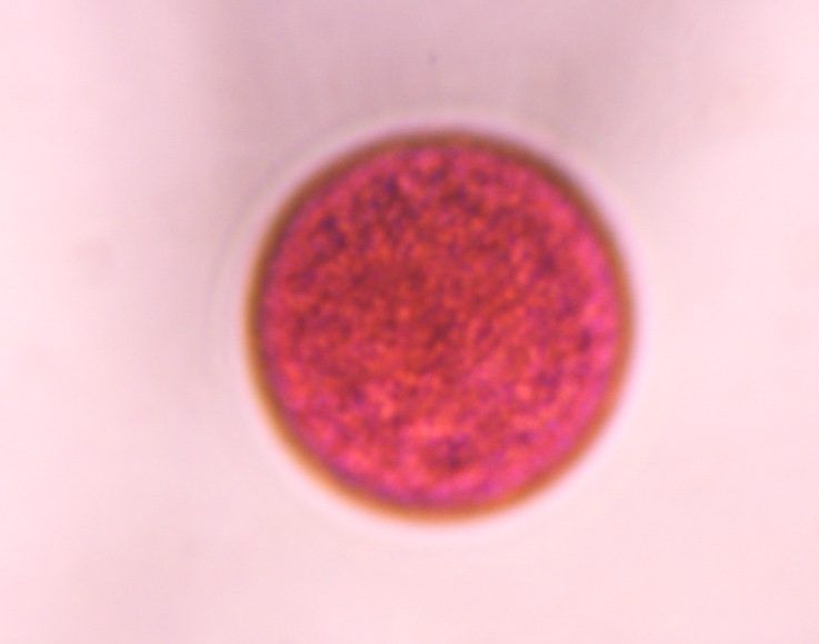Another microscope image of Poaceae, verified by PollyMap