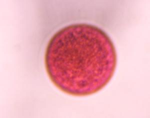 Poaceae pollen under a microscope, verified by PollyMap