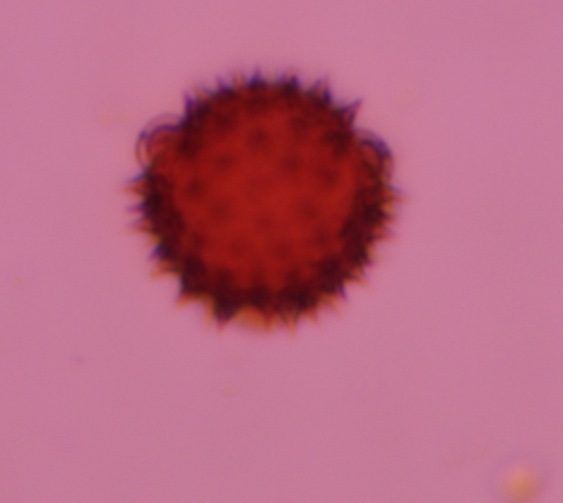 Asteraceae pollen under a microscope, verified by PollyMap