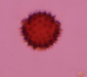 Asteraceae pollen under a microscope, verified by PollyMap