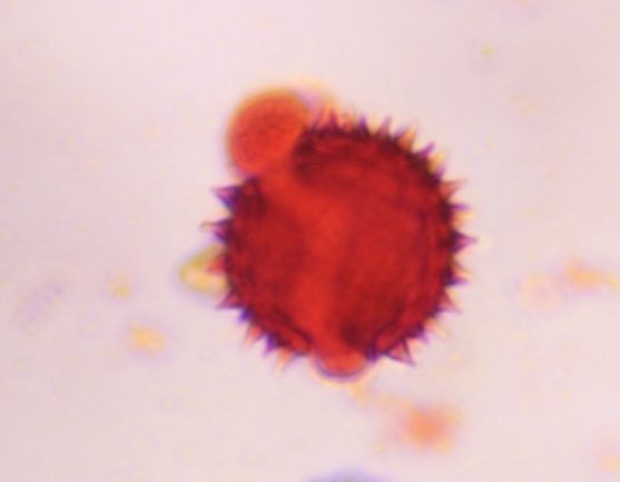 Another microscope image of Asteraceae, verified by PollyMap