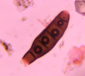 Bipolaris/Drechslera-type mold spore mold spore under a microscope, verified by PollyMap