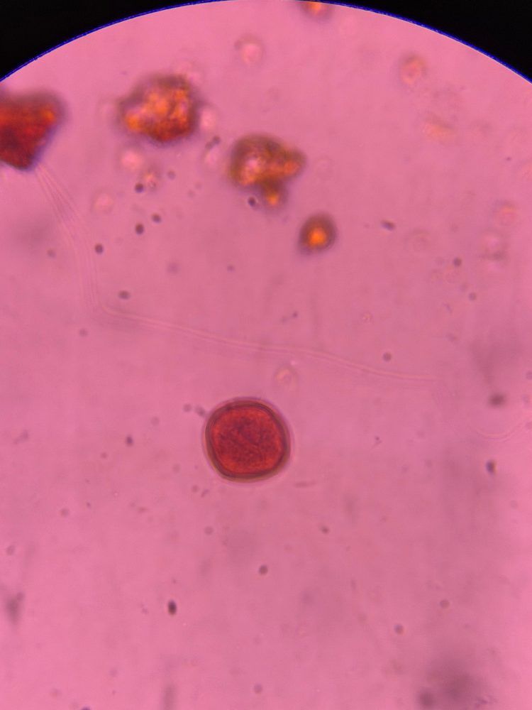 Oak pollen under a microscope, verified by PollyMap
