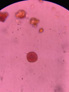 Oak pollen under a microscope, verified by PollyMap
