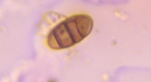 Curvularia mold spore under a microscope, verified by PollyMap