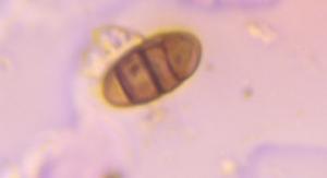 Curvularia mold spore under a microscope, verified by PollyMap