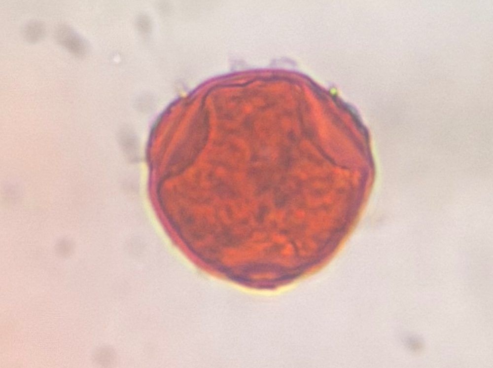 Hackberry pollen under a microscope, verified by PollyMap