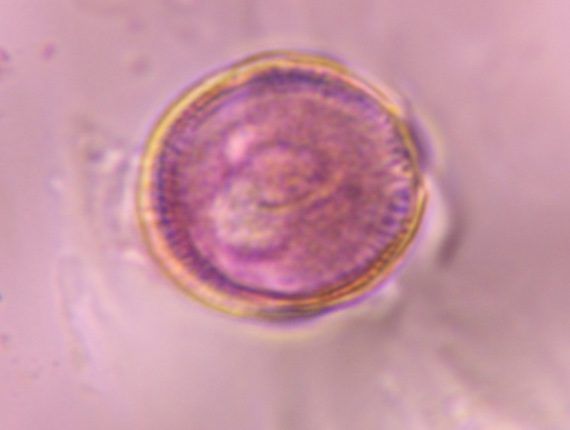 Another microscope image of Artemisia, verified by PollyMap