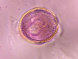 Artemisia pollen under a microscope, verified by PollyMap