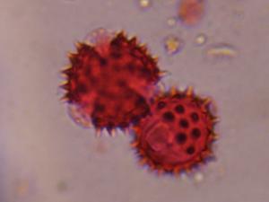 Asteraceae pollen under a microscope, verified by PollyMap