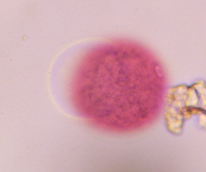 Grass pollen under a microscope, verified by PollyMap