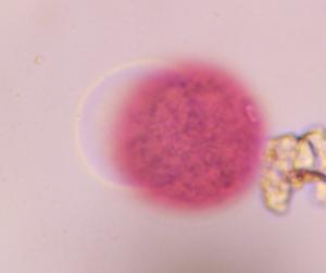Grass pollen under a microscope, verified by PollyMap