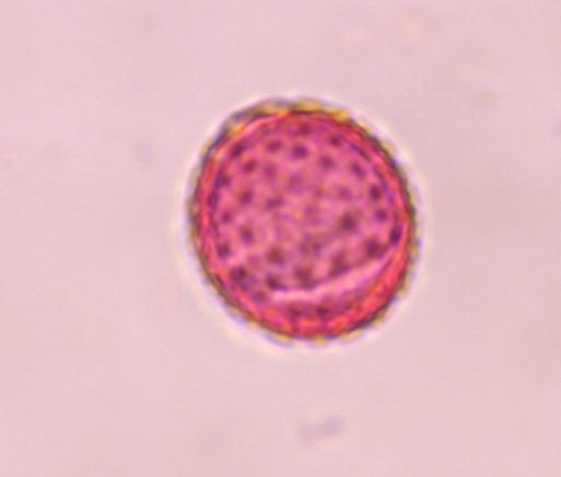 Another microscope image of Chenopod, verified by PollyMap