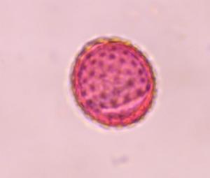 Chenopod pollen under a microscope, verified by PollyMap