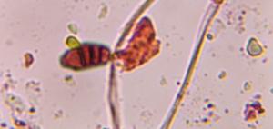 Curvularia mold spore under a microscope, verified by PollyMap