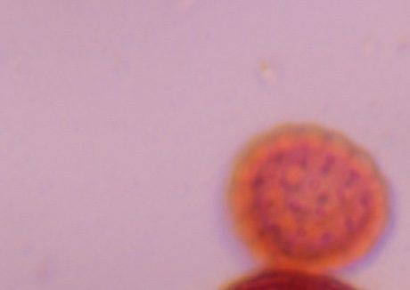 Chenopod pollen under a microscope, verified by PollyMap