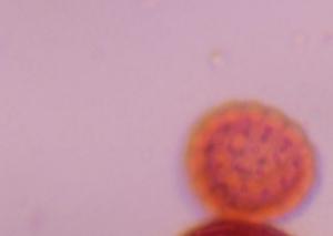 Chenopod pollen under a microscope, verified by PollyMap