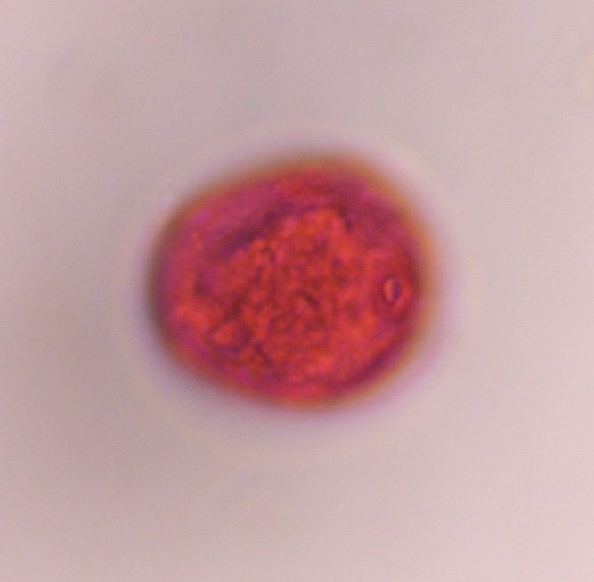 Grass pollen under a microscope, verified by PollyMap