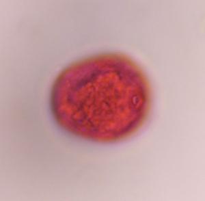 Grass pollen under a microscope, verified by PollyMap