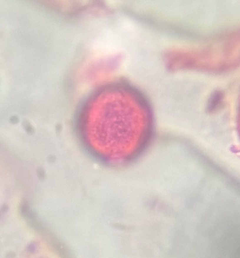 Nettle pollen under a microscope, verified by PollyMap