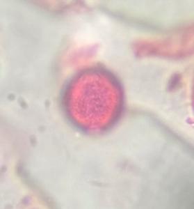 Nettle pollen under a microscope, verified by PollyMap