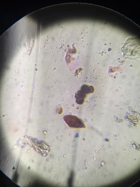 Another microscope image of Alternaria, verified by PollyMap